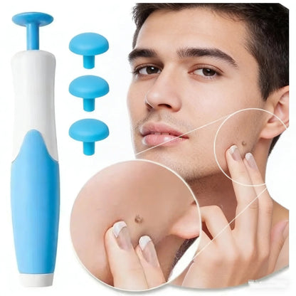 Dispositif Automatique 2-en-1 – Anti-Verrues & Grains de Beauté, Soin Visage